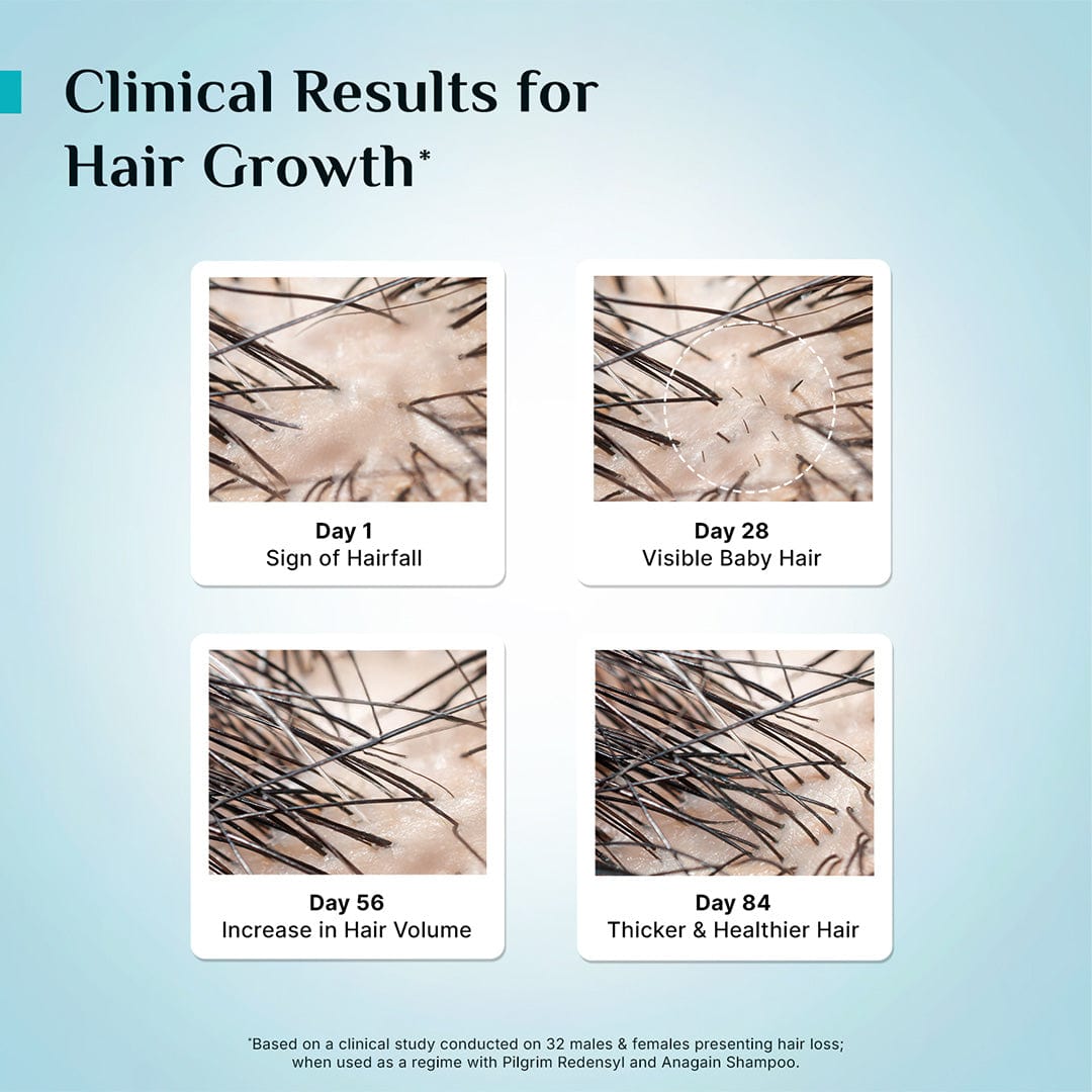 hair loss treatment